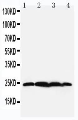 Invitrogen BAG2 Polyclonal Antibody 100 &mu;g; Unconjugated:Antibodies,