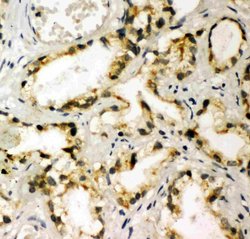 Invitrogen TBK1 Polyclonal Antibody 100 &mu;g; Unconjugated:Antibodies,