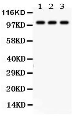 Invitrogen TBK1 Polyclonal Antibody 100 &mu;g; Unconjugated:Antibodies,