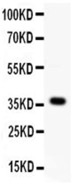Invitrogen WNT4 Polyclonal Antibody 100 &mu;g; Unconjugated:Antibodies,