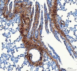 Invitrogen COL1A1 Polyclonal Antibody 100 &mu;g; Unconjugated:Antibodies,