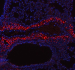 Invitrogen COL1A1 Polyclonal Antibody 100 &mu;g; Unconjugated:Antibodies,