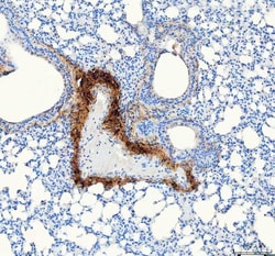 Invitrogen COL1A1 Polyclonal Antibody 100 &mu;g; Unconjugated:Antibodies,