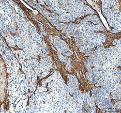 Invitrogen COL1A1 Polyclonal Antibody 100 &mu;g; Unconjugated:Antibodies,