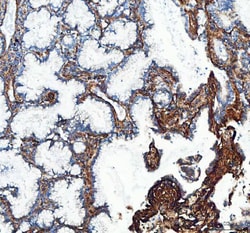 Invitrogen COL1A1 Polyclonal Antibody 100 &mu;g; Unconjugated:Antibodies,