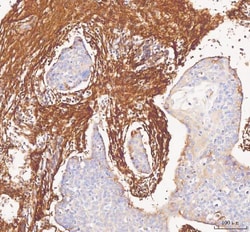 Invitrogen COL1A1 Polyclonal Antibody 100 &mu;g; Unconjugated:Antibodies,