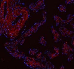 Invitrogen COL1A1 Polyclonal Antibody 100 &mu;g; Unconjugated:Antibodies,