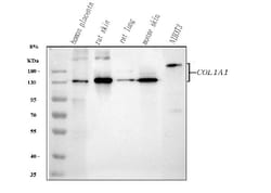 Invitrogen COL1A1 Polyclonal Antibody 100 &mu;g; Unconjugated:Antibodies,