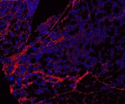 Invitrogen COL1A1 Polyclonal Antibody 100 &mu;g; Unconjugated:Antibodies,