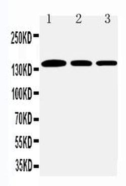 Invitrogen COL1A1 Polyclonal Antibody 100 &mu;g; Unconjugated:Antibodies,