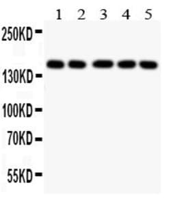 Invitrogen Collagen II Polyclonal Antibody 100 &mu;g; Unconjugated:Antibodies,