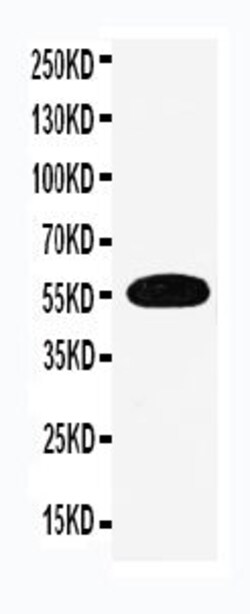 EAAC1 Polyclonal Antibody:Antibodies, Polyclonal