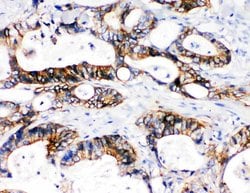 Invitrogen NKCC1 Polyclonal Antibody 100 &mu;g; Unconjugated:Antibodies,