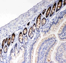 Invitrogen NKCC1 Polyclonal Antibody 100 &mu;g; Unconjugated:Antibodies,