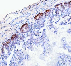 Invitrogen NKCC1 Polyclonal Antibody 100 &mu;g; Unconjugated:Antibodies,