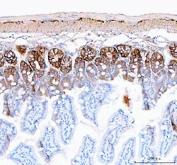 Invitrogen NKCC1 Polyclonal Antibody 100 &mu;g; Unconjugated:Antibodies,
