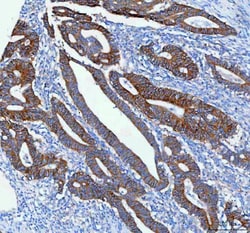 Invitrogen NKCC1 Polyclonal Antibody 100 &mu;g; Unconjugated:Antibodies,