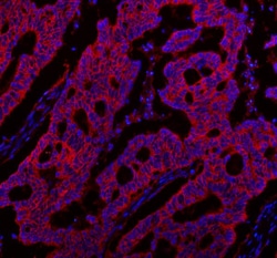 Invitrogen NKCC1 Polyclonal Antibody 100 &mu;g; Unconjugated:Antibodies,