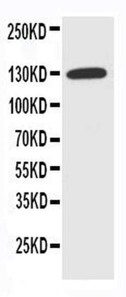 Invitrogen NKCC1 Polyclonal Antibody 100 &mu;g; Unconjugated:Antibodies,
