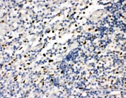 Invitrogen FLI1 Polyclonal Antibody 100 &mu;g; Unconjugated:Antibodies,
