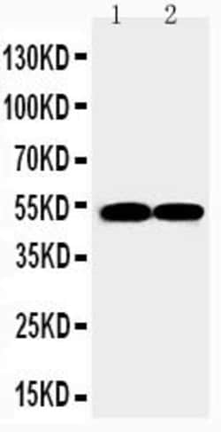 Invitrogen FLI1 Polyclonal Antibody 100 &mu;g; Unconjugated:Antibodies,