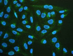 Invitrogen CHRM1 Polyclonal Antibody 100 &mu;g; Unconjugated:Antibodies,