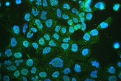 Invitrogen CHRM1 Polyclonal Antibody 100 &mu;g; Unconjugated:Antibodies,