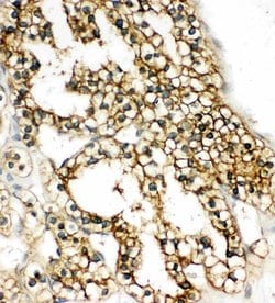 Invitrogen COMT Polyclonal Antibody 100 &mu;g; Unconjugated:Antibodies,