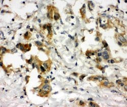 Invitrogen COMT Polyclonal Antibody 100 &mu;g; Unconjugated:Antibodies,