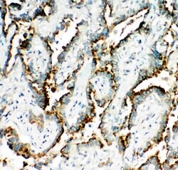 IRAK-M Polyclonal Antibody, Invitrogen 100 &mu;g; Unconjugated:Antibodies,