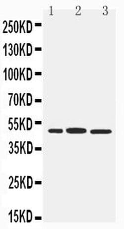 Invitrogen IRF8 Polyclonal Antibody 100 &mu;g; Unconjugated:Antibodies,