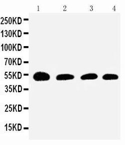 Invitrogen SERPINC1 Polyclonal Antibody 100 &mu;g | Buy Online | Invitrogen&trade; | Fisher Scientific