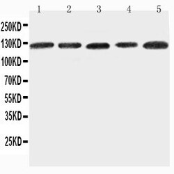 Invitrogen ITGA7 Polyclonal Antibody 100 &mu;g; Unconjugated:Antibodies,