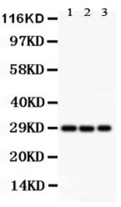 Invitrogen KChIP3 Polyclonal Antibody 100 &mu;g; Unconjugated:Antibodies,