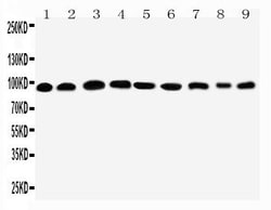 Invitrogen PKP2 Polyclonal Antibody 100 &mu;g; Unconjugated:Antibodies,