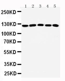Invitrogen ST5 Polyclonal Antibody 100 &mu;g; Unconjugated:Antibodies,
