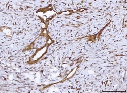 Invitrogen COX1 Polyclonal Antibody 100 &mu;g | Buy Online | Invitrogen&trade; | Fisher Scientific