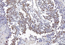 Invitrogen COX1 Polyclonal Antibody 100 &mu;g | Buy Online | Invitrogen&trade; | Fisher Scientific