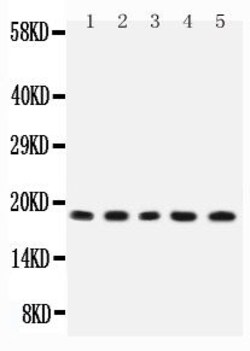 Invitrogen IL-2 Polyclonal Antibody 100 &mu;g; Unconjugated:Antibodies,