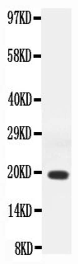 Invitrogen IFN gamma Polyclonal Antibody 100 &mu;g; Unconjugated:Antibodies,
