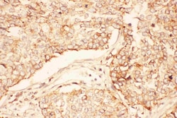 Invitrogen AKT2 Polyclonal Antibody 100 &mu;g; Unconjugated:Antibodies,