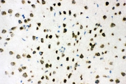 Invitrogen AKT2 Polyclonal Antibody 100 &mu;g; Unconjugated:Antibodies,