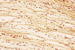 Invitrogen AKT2 Polyclonal Antibody 100 &mu;g; Unconjugated:Antibodies,