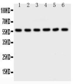 Invitrogen AKT2 Polyclonal Antibody 100 &mu;g; Unconjugated:Antibodies,