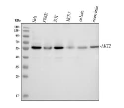 Invitrogen AKT2 Polyclonal Antibody 100 &mu;g; Unconjugated:Antibodies,
