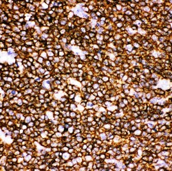 Invitrogen CD20 Polyclonal Antibody 100 &mu;g | Buy Online | Invitrogen&trade; | Fisher Scientific