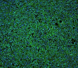 Invitrogen CD20 Polyclonal Antibody 100 &mu;g | Buy Online | Invitrogen&trade; | Fisher Scientific