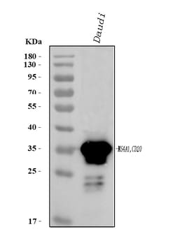 Invitrogen CD20 Polyclonal Antibody 100 &mu;g | Buy Online | Invitrogen&trade; | Fisher Scientific