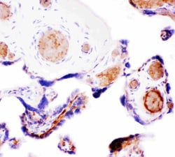 Invitrogen WNT5A Polyclonal Antibody 100 &mu;g; Unconjugated:Antibodies,