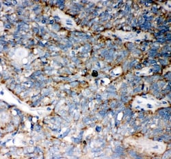 Invitrogen WNT5A Polyclonal Antibody 100 &mu;g; Unconjugated:Antibodies,
